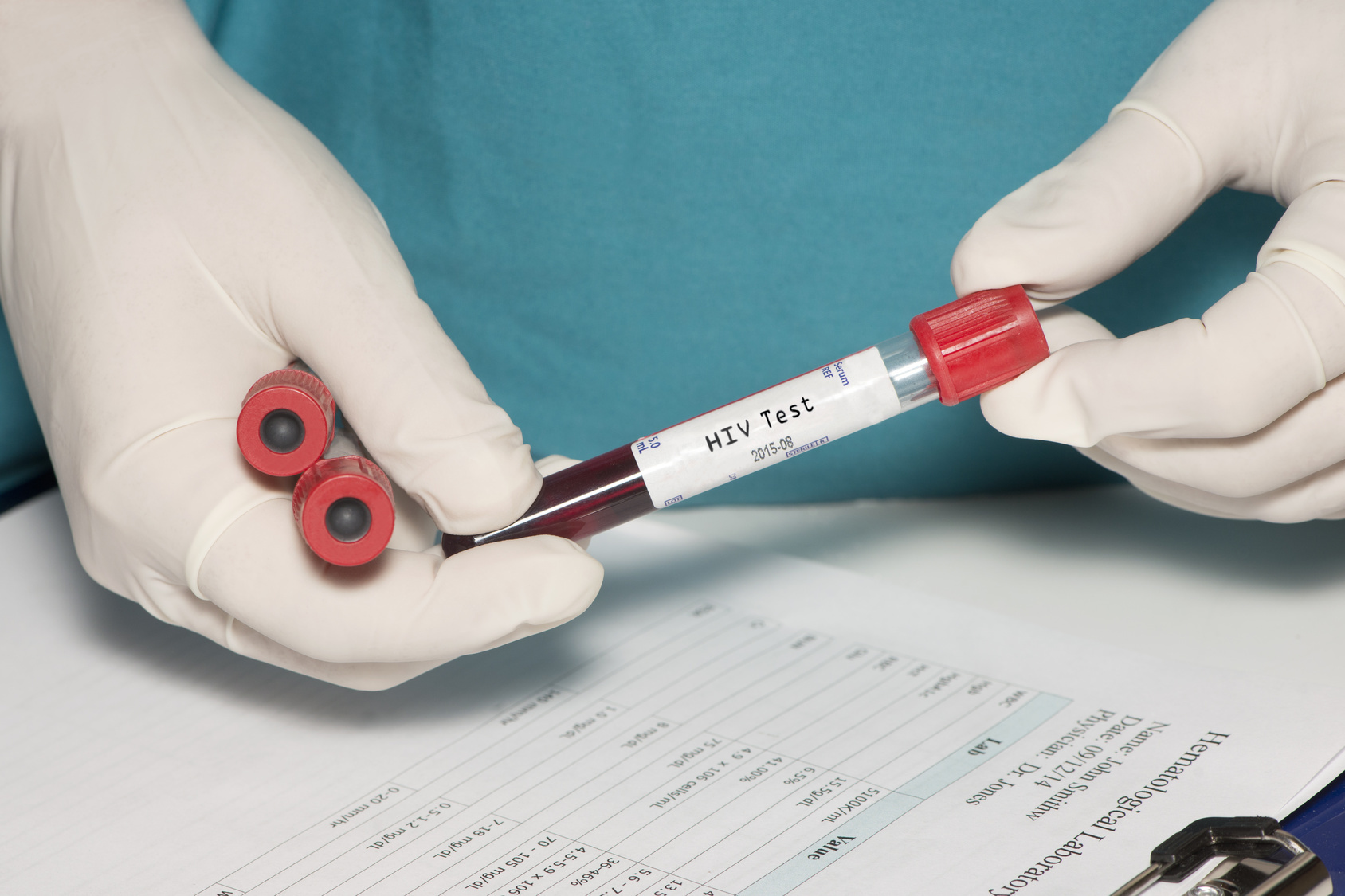 Am 30. Juni 2016 wird die HIV-Ambulanz schließen.