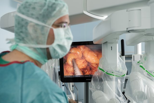 Die Operation im Inneren des Patienten wird auf der Bildschirmkonsole für das OP-Team übertragen. | Foto: Klinikum Nürnberg / Rudi Ott