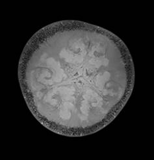 MRT-Aufnahme einer Melone | Foto: Klinikum Forchheim-Fränkische Schweiz