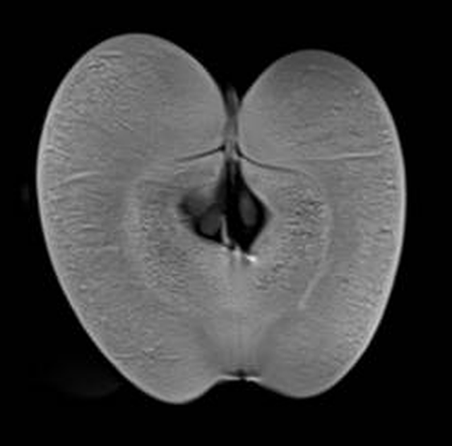 MRT-Aufnahme eines Apfels | Foto: Klinikum Forchheim-Fränkische Schweiz