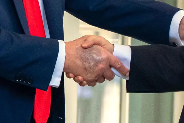 Zu sehen beim Händedruck mit dem südkoreanischen Präsidenten Lee: ein Bluterguss auf Trumps rechter Hand. 
 | Foto: Alex Brandon/AP/dpa